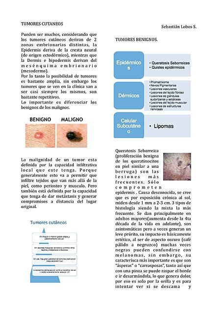 Resumen Sobre Tumores Cutáneos Benignos Dermatología Apuntes Médicos