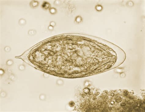 Schistosomiasis Parasite Eggs