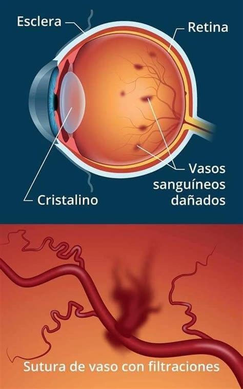 Pin De Cristhian Maria Jir N Aguirre En Oftalmo Anatom A Del Ojo