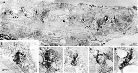 Immuno Electron Microscopic Analysis Of Occludin Expression In Vessels