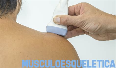 ECOGRAFÍA MUSCULOESQUELÉTICA ECODIAGNOSTIC EN 48 H