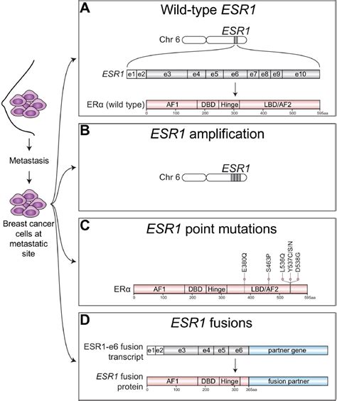 Esr Alterations And Metastasis In Estrogen Receptor Positive Breast Cancer