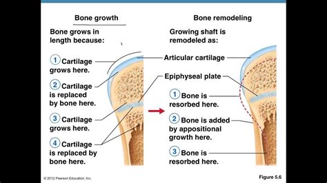 Remodeling Of Bone - Bone Formation And Remodeling Tobig / Related online courses on physioplus ...