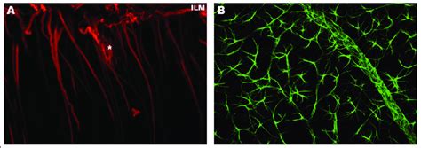 Immunohistochemistry Anti Gfap In Mouse Retinal Whole Mount A Gfap