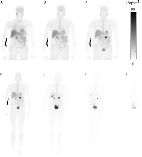 Figure 1 From Whole Body Biodistribution And Dosimetry Of The Dopamine