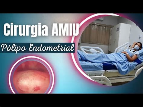 Cirurgia AMIU Aspiração Manual Intra Uterina Retirada de Pólipo