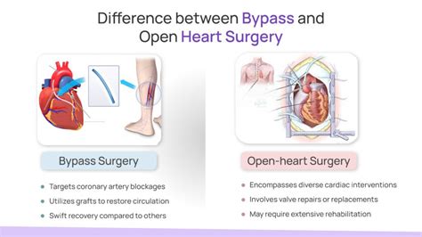 Difference between Bypass and Open Heart Surgery