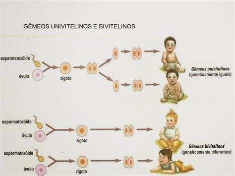 Vida De Mãe De Gêmeos Univitelinos Ou Bivitelinos