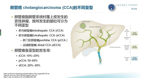 肝内胆管细胞癌，到底是肝癌还是胆管癌？肝内胆管癌 好大夫在线
