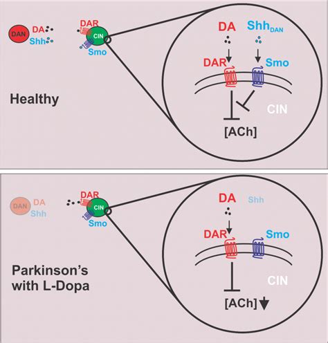 Sonic Hedgehog Protein Pathway Stimulation Could Help Treat Parkinsons