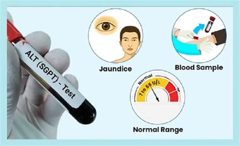 What Is SGPT Test Normal Ranges Uses Causes Symptoms More