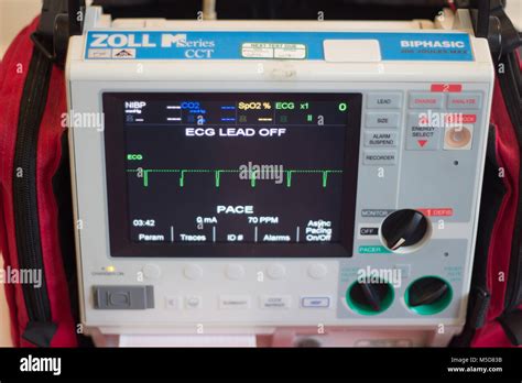 Ecg In Myocardial Infarction Banque De Photographies Et Dimages