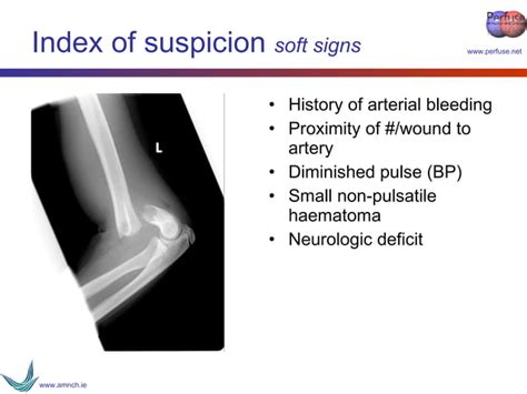 Vascular Trauma Ppt