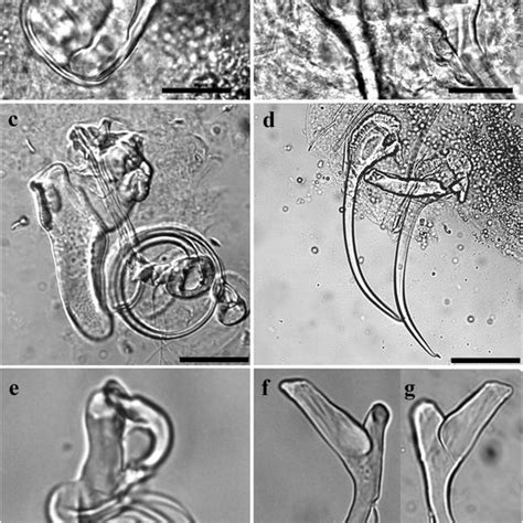 Three Dimensional Reconstruction Of Sclerotized Structures Of