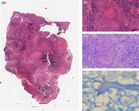 Histopathological Features He Staining Of Skin Tissue Showing Download Scientific Diagram