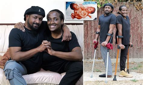 Conjoined Twins Married To One Man