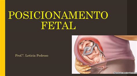 PDF POSICIONAMENTO FETAL Irp Cdn Multiscreensite 17