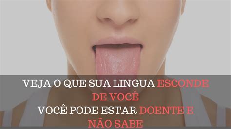 Lingua Branca O Que Pode Ser Sua Lingua Esconde Doen As Como Ter Uma