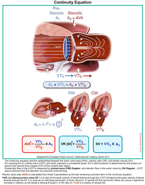 Valvular Emergencies Diagnosis And Management Of Severe Aortic