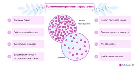 Парестезия конечностей простыми словами: причины, лечение