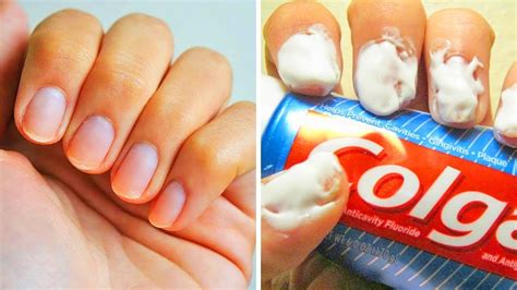 20 Easy Hacks For Perfect Nails Youtube