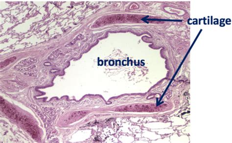 Bronchus Slide Labelled