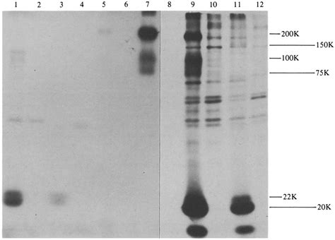 SDS PAGE Analysis Of Pellet Material After Ultracentrifugation Of