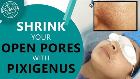 Shrink Your Open Pores With Pixigenus Youtube