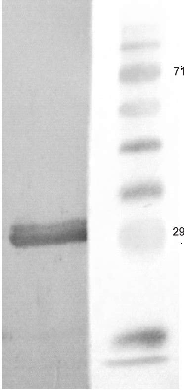 Western Blot Showing Purified Recombinant Ts14 Reactivity To Anti Sera