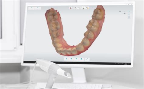 Computer Guided Dentistry In Worcestershire West Midlands Roy Morris