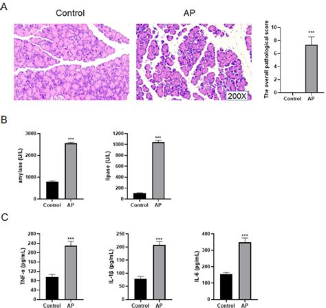 Mir P Ameliorates Pancreatic Acinar Cell Injury By Targeting