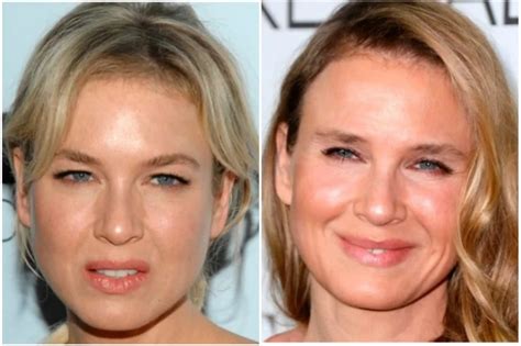 Renée Zellweger Habló Por Primera Vez De Su Depresión Mi Vida Estaba