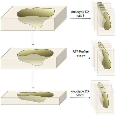 Scheme Of A Paraffin Tissue Block Undergoing Molecular Pathology