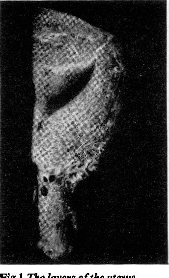 Figure 1 From The Anatomy Of The Utero Tubal Junction Area Semantic