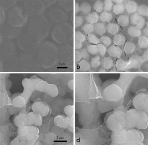 Conventional SEM Images Of Synechocystis Sp PCC 6803 Prepared By