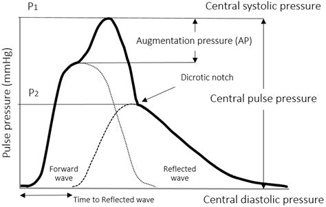 Figure And Table Carotid Pulse Wave Analysis Future Direction Of