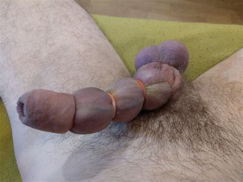 Banded My Cock To A Huge Worm Nude Pics Xhamster