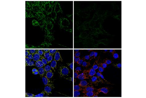 Tom E E M Rabbit Mab Cell Signaling Technology