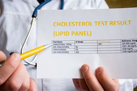 The Medical Minute Never Had A Lipid Panel Heres Why Its Important