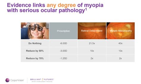 Assessing Risk Of Myopia Onset And Progression Myopia 48 Off