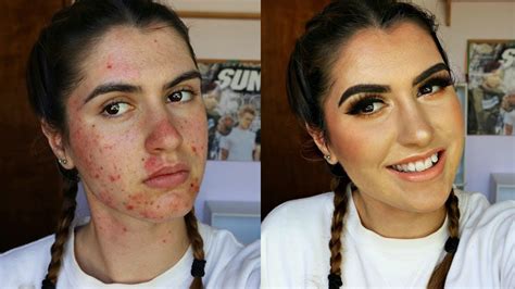 How To Cover Acne Scars Breakouts Full Coverage W Drugstore