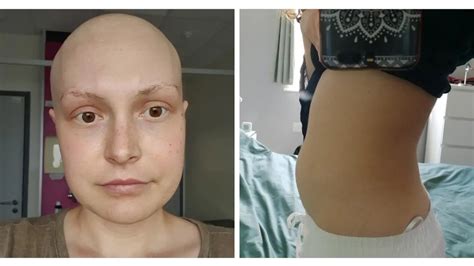 Ladbible On Twitter Rt Tyla 🔔 Woman Who Ignored Cancer Symptoms For Months Urges Other