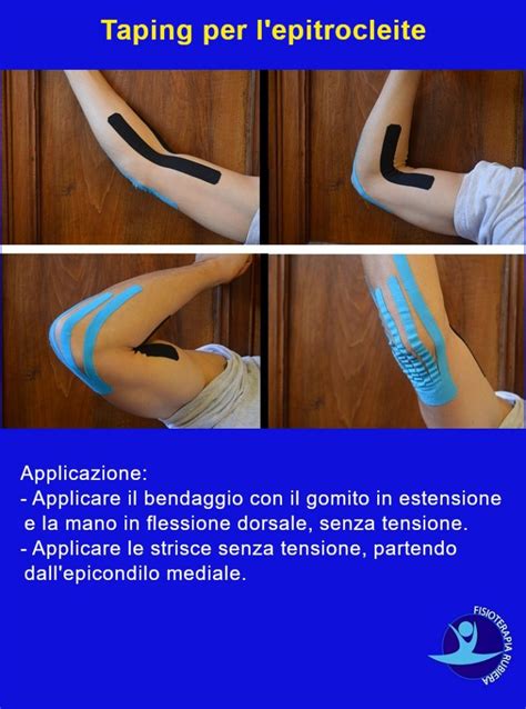 Epitrocleite Del Gomito FisioTerapia Ed Esercizi Di Riabilitazione