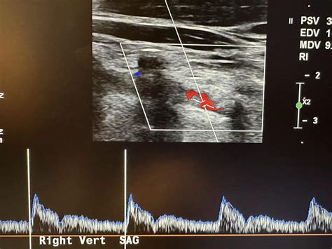 Vascular Sonography Ultrasound Physics And Its Application In Medicine