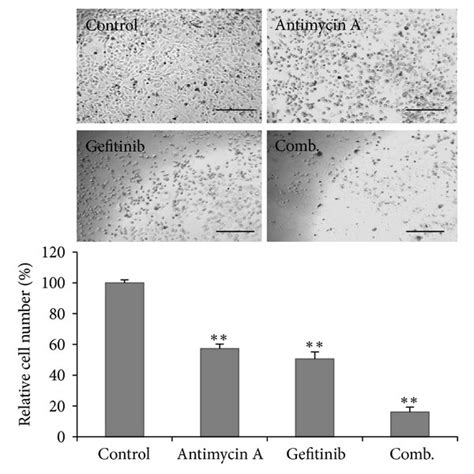 Antimycin A Overcomes Gefitinib Resistance In Lung Cancer Cells A