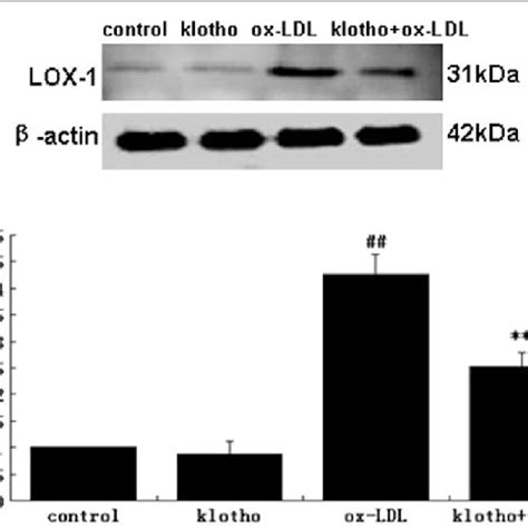 Lox 1 Expression In Huvecs Under Similar Treatment Conditions As