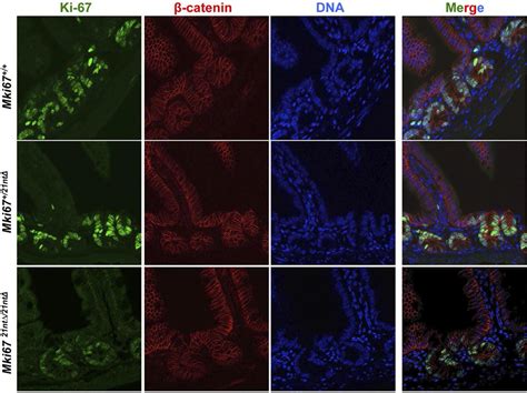 Figures And Data In The Cell Proliferation Antigen Ki 67 Organises