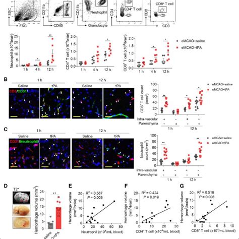 Tpa Tissue Type Plasminogen Activator Facilitates The Migration Of Download Scientific