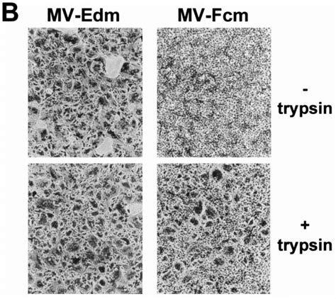 Infection With Recombinant Mv A Western Blot Analysis Of Mv Infected Download Scientific