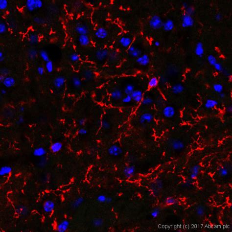 Microglia Marker Cd11b Cd45 Iba1 Tmem119 Antibody Sampler Panel